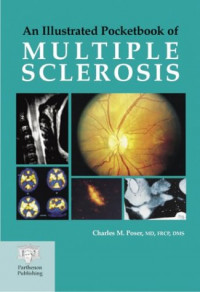 An Illustrated Pocketbook of Multiple Sclerosis.